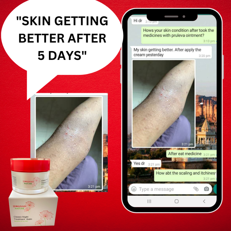 rawatan psoriasis sembuh