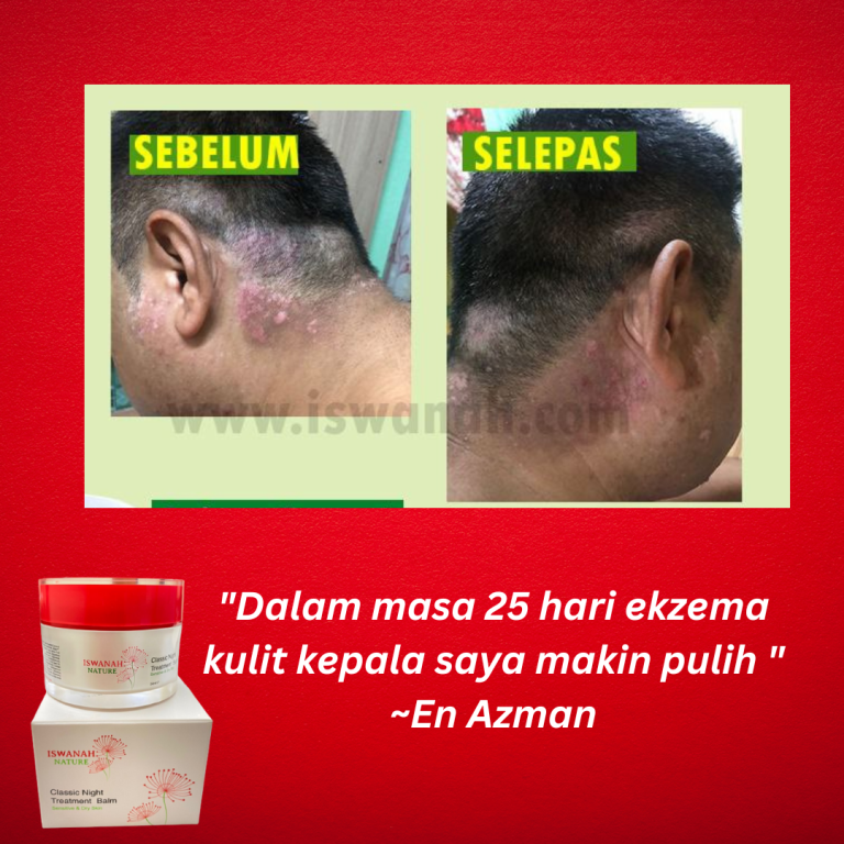 rawatan psoriasis sembuh