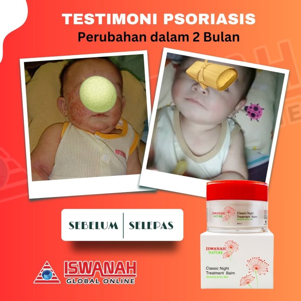 treatment balm