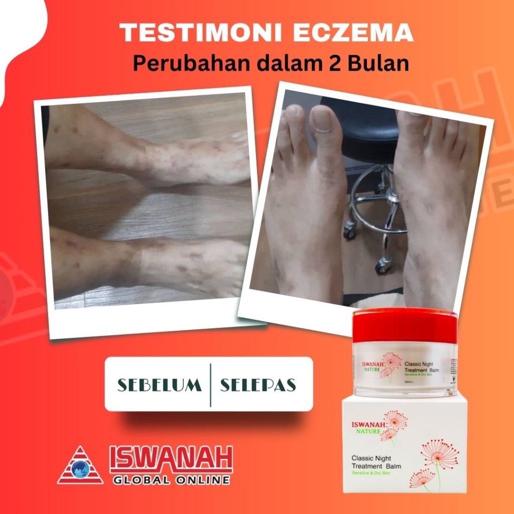 treatment balm